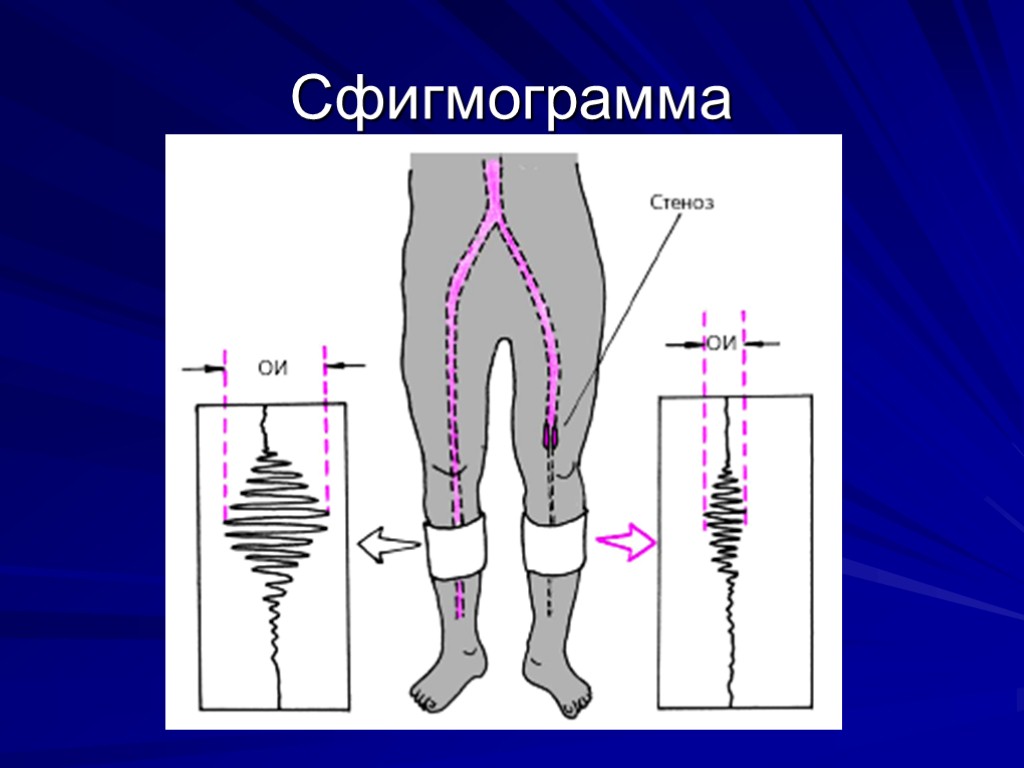 Артерии нижних конечностей фото